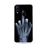 CALROVTE Case For BQ 6040L Wolf Silicon TPU Cover for BQ-6040L Magic Cat Animal Shell Bag Housing Phone Cases for BQ 6040 L